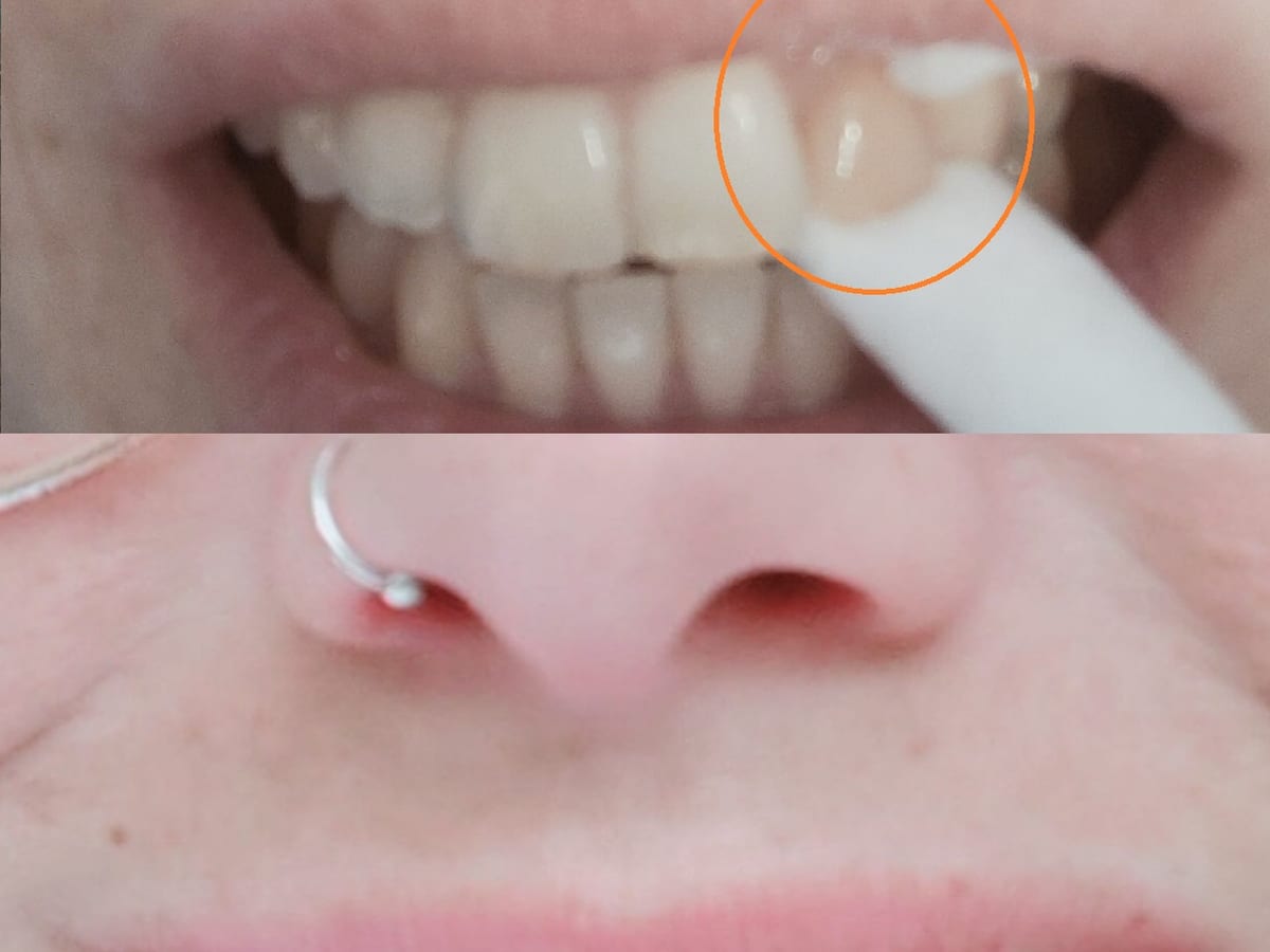 Clínica Dental Ayala — foto 3