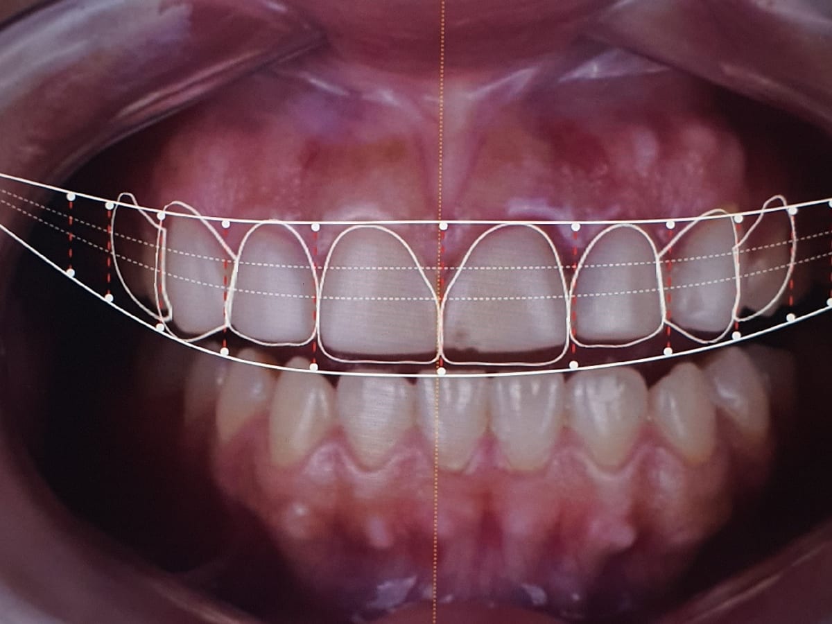 Dentius — foto 2